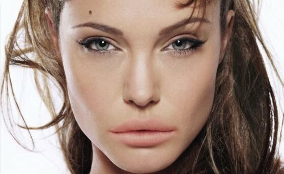 Οι διάσημοι με τα χείλη της Lana Del Ray