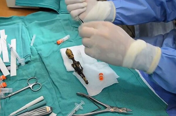 Ο μικροσκοπικός 'εξωγήινος' σκελετός περιέχει ανθρώπινο DNA