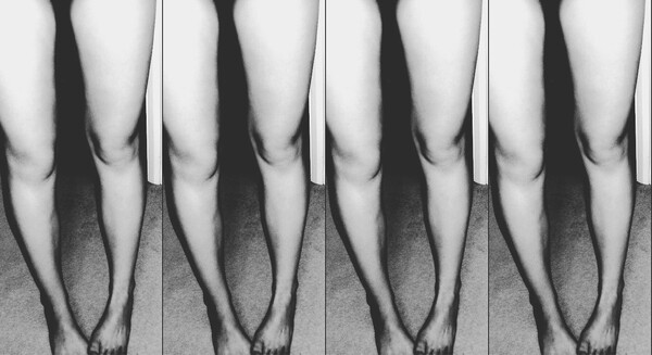 Thigh Gap