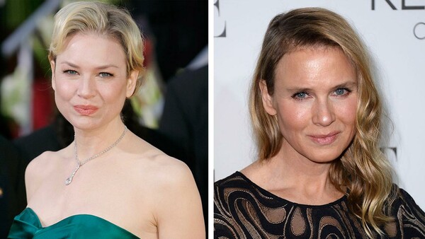 Πώς το πρόσωπο της Renee Zellweger δίχασε το ίντερνετ