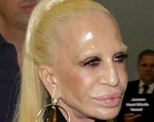 To πρόσωπο της Donatella Versace γίνεται (και πάλι) πρωτοσέλιδο στα tabloids