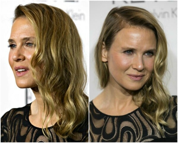 Πώς το πρόσωπο της Renee Zellweger δίχασε το ίντερνετ