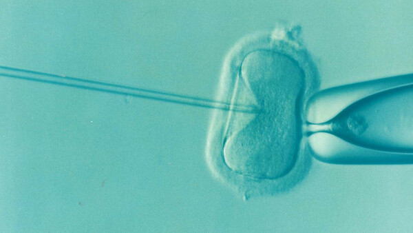 Νοσοκομείο «Αττικόν»: H πρώτη ωοληψία για εξωσωματική γονιμοποίηση σε ζευγάρι με κορωνοϊό