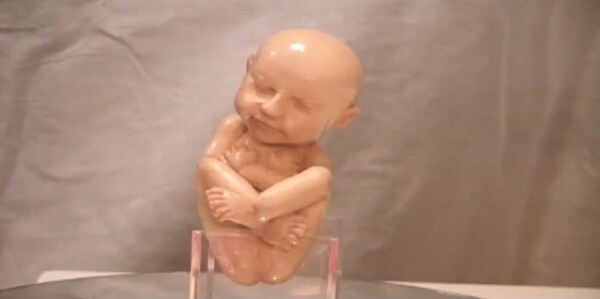 Τώρα και 3D εκτύπωση αγέννητων μωρών