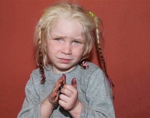 Ιρλανδία: 7χρονο κοριτσάκι πήραν οι αστυνομικοί από οικογένεια Ρομά