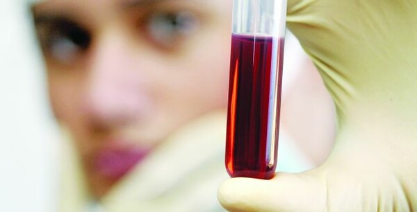 Έφτιαξαν τεχνητό αίμα από βλαστοκύτταρα