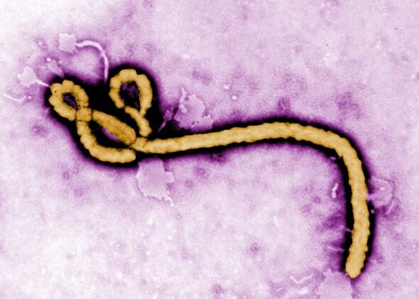 Πωλείται το ebola.com