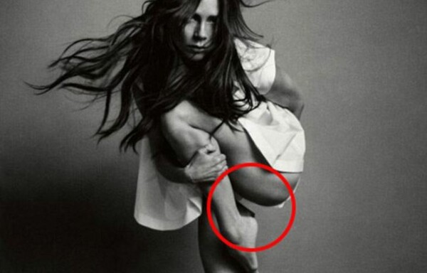 H Vogue απαντά για το "κομμένο" πόδι της Victoria Beckham