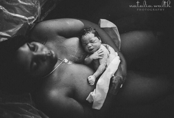 Η σκληρή ομορφιά της γέννας σε ρεαλιστικές φωτογραφίες που βραβεύθηκαν