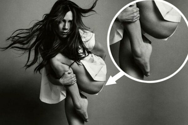 Photoshop Fail - Η Victoria Beckham φωτογραφήθηκε για τη Vogue, αλλά κάτι περίεργο συμβαίνει με το πόδι της