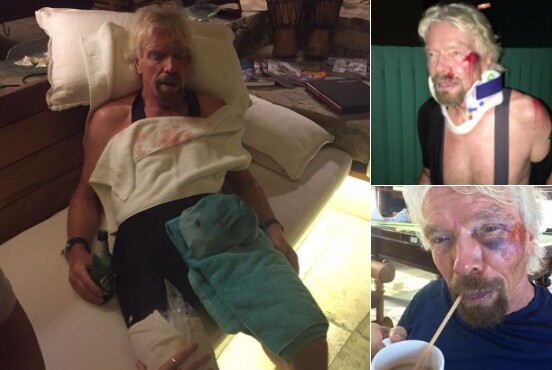 "Πίστεψα πως θα πεθάνω" λέει ο ιδιοκτήτης της Virgin, Richard Branson, που είχε ατύχημα με το ποδήλατό του