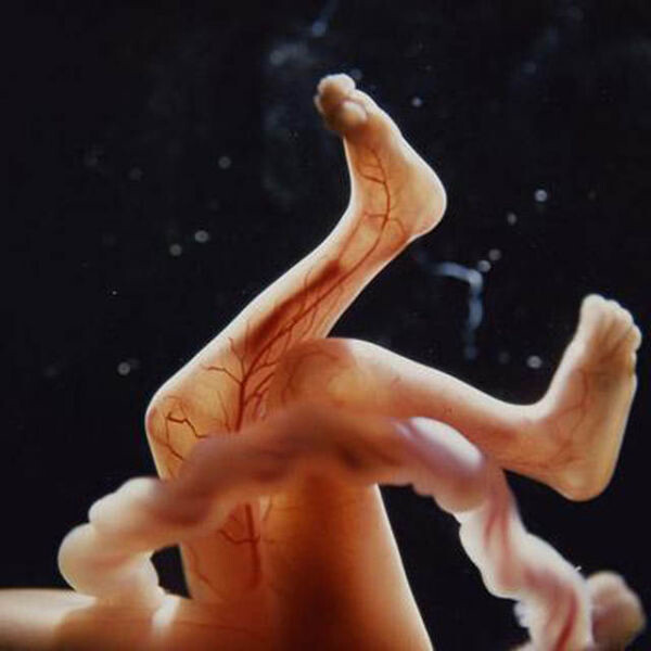 Ο άνθρωπος που πρώτος φωτογράφισε τη γέννηση της ζωής δεν βρίσκεται πια στη ζωή