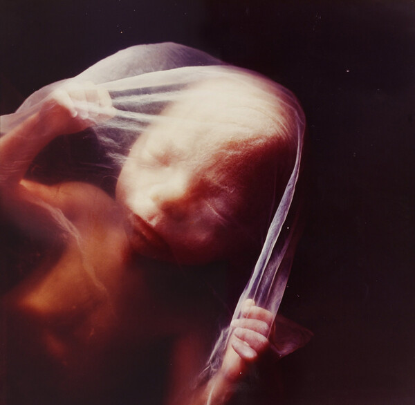 Ο άνθρωπος που πρώτος φωτογράφισε τη γέννηση της ζωής δεν βρίσκεται πια στη ζωή