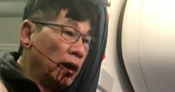 ΗΠΑ: Ο επιβάτης της United Airlines που σύρθηκε με τη βία έξω από το αεροσκάφος μάλλον θα καταθέσει μήνυση