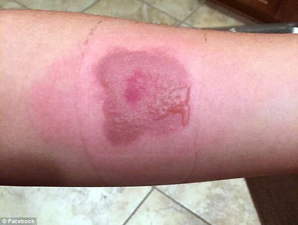 «Salt and Ice Challenge»: Το νέο επικίνδυνο διαδικτυακό παιχνίδι που ήρθε και στην Ευρώπη - Η προειδοποίηση Σφακιανάκη