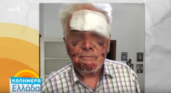 Άγριος ξυλοδαρμός 90χρονου στο Γαλάτσι για να του κλέψουν 5 ευρώ (ΒΙΝΤΕΟ)