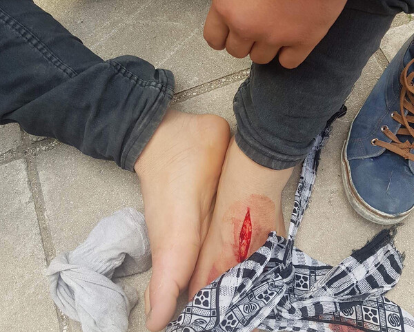 Καταγγελία ότι λιμενικοί μαχαίρωσαν στο πόδι 14χρονο πρόσφυγα στην Πάτρα
