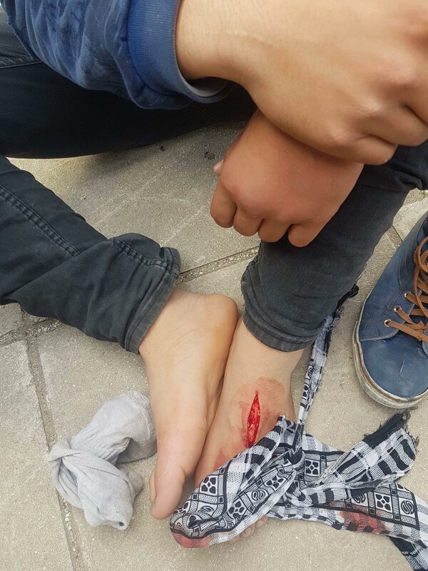 Καταγγελία ότι λιμενικοί μαχαίρωσαν στο πόδι 14χρονο πρόσφυγα στην Πάτρα