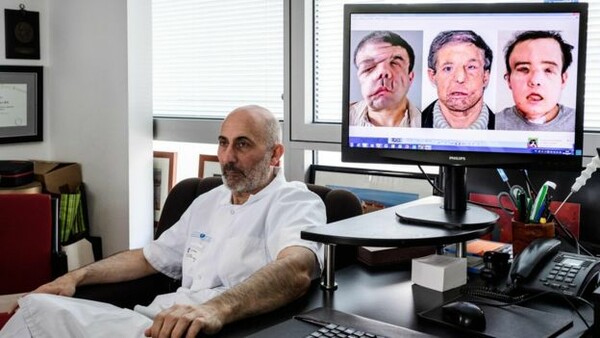 Ο «άνθρωπος με τα τρία πρόσωπα» έγινε ο πρώτος ασθενής παγκοσμίως που έχει κάνει δύο μεταμοσχεύσεις