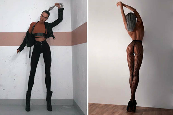 Η Σουηδέζα bodybuilder με τα υπερφυσικά πόδια λέει πως κάποτε δεχόταν bullying για την εμφάνισή της