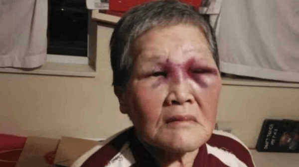 ΗΠΑ: 39χρονος έριξε γροθιά σε 75χρονη ασιατικής καταγωγής στον δρόμο- Εκείνη άρπαξε σανίδα και άρχισε να τον χτυπά