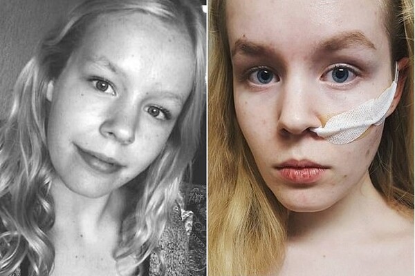Μια 17χρονη στην Ολλανδία, που βιάστηκε όταν ήταν παιδί, πέθανε στο σπίτι της (update με διόρθωση)