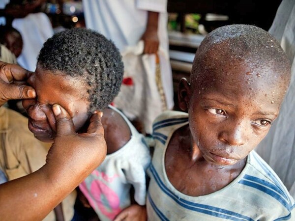 Σκότωσαν και διαμέλισαν δέκα παιδιά σε τελετές μαγείας στην Τανζανία
