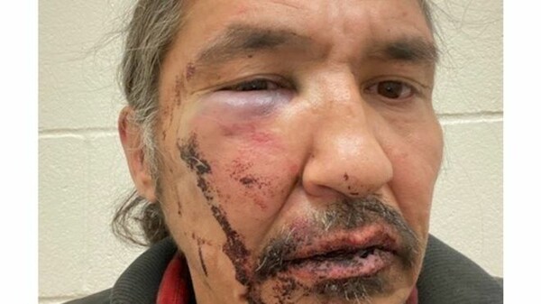 Κατακραυγή στον Καναδά από τη βίαιη σύλληψη Καναδού αυτόχθονα - Τριντό: «Σοκαριστικό»