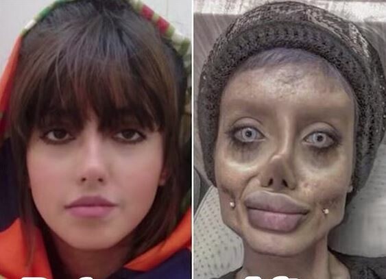 Διαπόμπευσαν στην τηλεόραση την 22χρονη που έγινε διάσημη στο Instagram λόγω ακραίας «εμφάνισης» και συνελήφθη