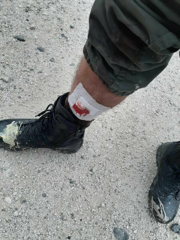 Λέσβος: Ταμπουρωμένες σε στρατόπεδο διμοιρίες των ΜΑΤ - Καταγγελίες αστυνομικών για τραυματισμούς από σκάγια