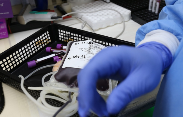 Μεταδίδεται ο κορωνοϊός με την μετάγγιση αίματος; Τι δείχνει νέα έρευνα
