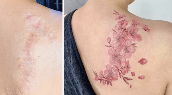 Καλλιτέχνιδα των τατουάζ στολίζει παλιές πληγές με λουλούδια και πορτρέτα ζώων