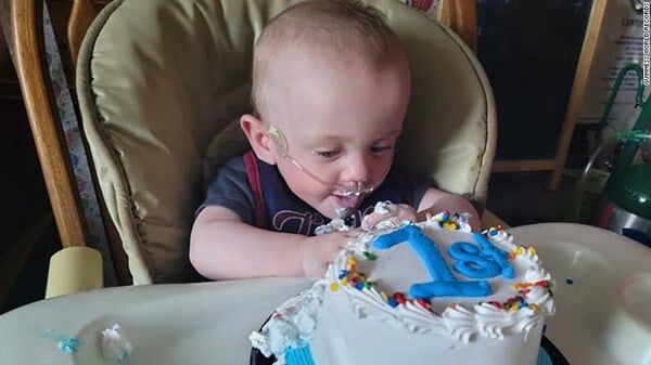 The world's most premature baby has celebrated his first birthday after beating 0% odds of surviving