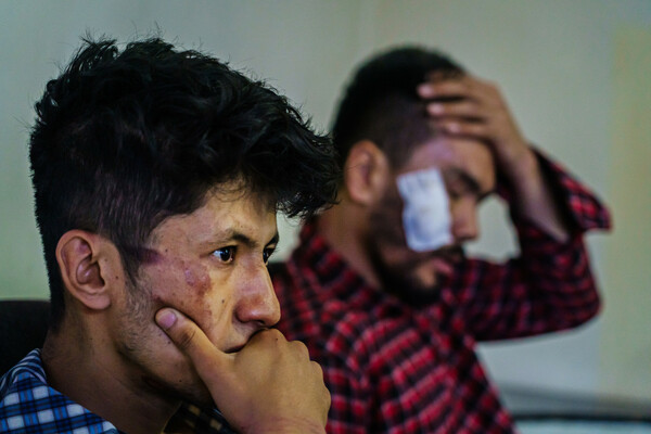 Αφγανιστάν: Οι Ταλιμπάν συνέλαβαν και ξυλοκόπησαν άγρια δημοσιογράφους- Σκληρές εικόνες