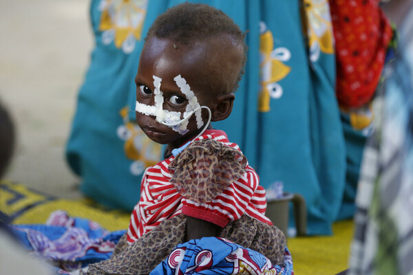 Πάνω από 11 εκατομμύρια παιδια κάτω των 2 ετών σε επισιτιστική επισφάλεια, προειδοποιεί η Unicef 