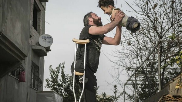 Η Ιταλία δίνει καταφύγιο σε πατέρα και γιο που ακρωτηριάστηκαν από βόμβες στη Συρία