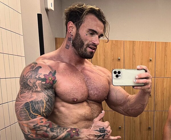 Ο πρώην Mr. Universe, Calum von Moger, δίνει μάχη για τη ζωή του- Έπεσε από παράθυρο δεύτερου ορόφου