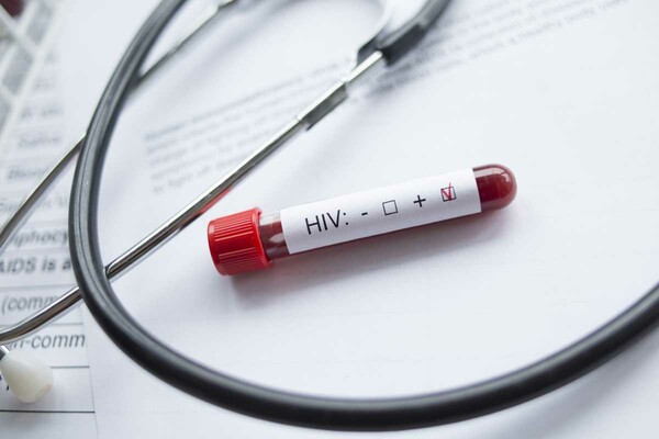 Δύο άνθρωποι με HIV φαίνεται να νίκησαν τον ιό και δίνουν ελπίδα για θεραπεία
