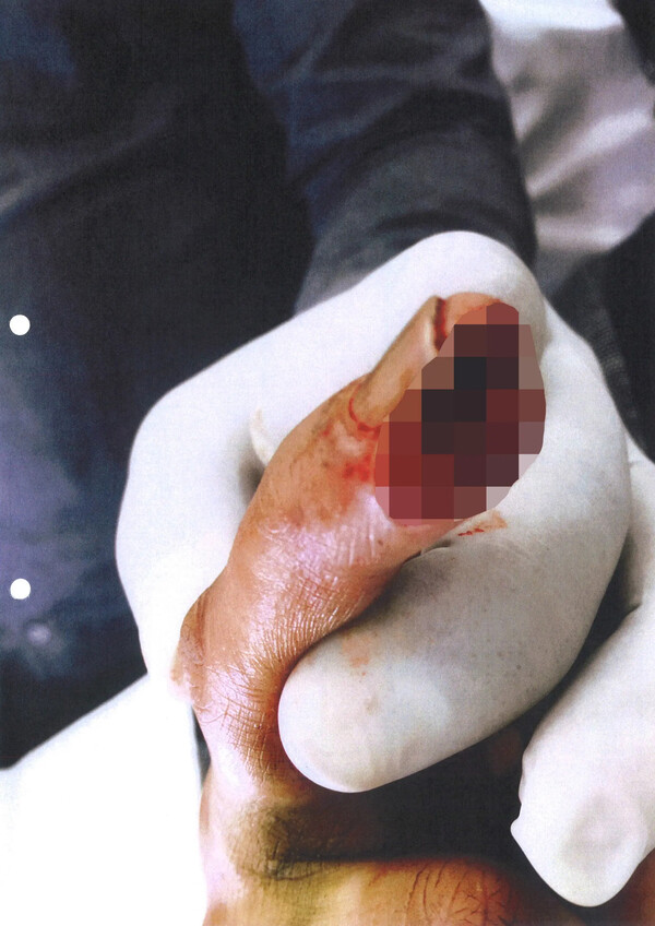 «Του έκοψε το δάχτυλο»: Η αντίδραση της αδελφής Άμπερ Χερντ όταν έμαθε για τον τραυματισμό του Τζόνι Ντεπ