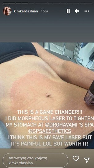 Η Κιμ Καρντάσιαν ανάρτησε φωτογραφία από την «επώδυνη» θεραπεία για σύσφιξη στο στομάχι της