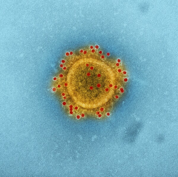 «Κένταυρος»: Το στέλεχος BA.2.75.2 φαίνεται πως «διαφεύγει» ανοσίας και εμβολίων