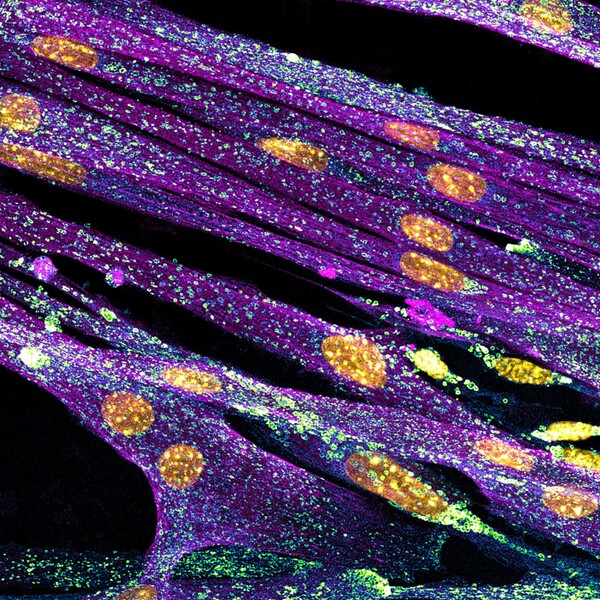 Nikon Small World Photomicrography: Οι νικητές του διαγωνισμού που δημιουργούν τέχνη μέσα από το μικροσκόπιο