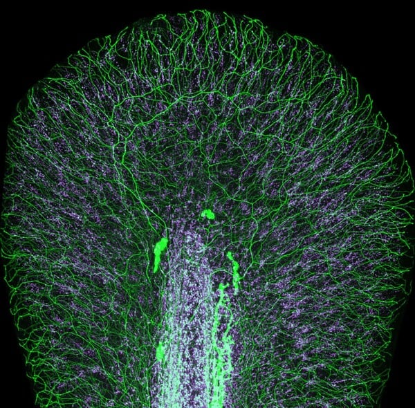 Nikon Small World Photomicrography: Οι νικητές του διαγωνισμού που δημιουργούν τέχνη μέσα από το μικροσκόπιο