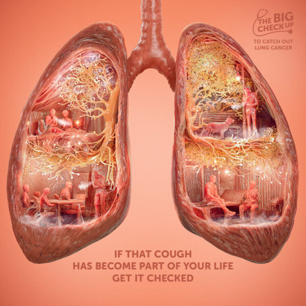«Αν αυτός ο βήχας έχει γίνει μέρος της ζωής σας, ελέγξετε το»: Αφίσες ευαισθητοποιούν τους Ιρλανδούς για τον καρκίνο του πνεύμονα