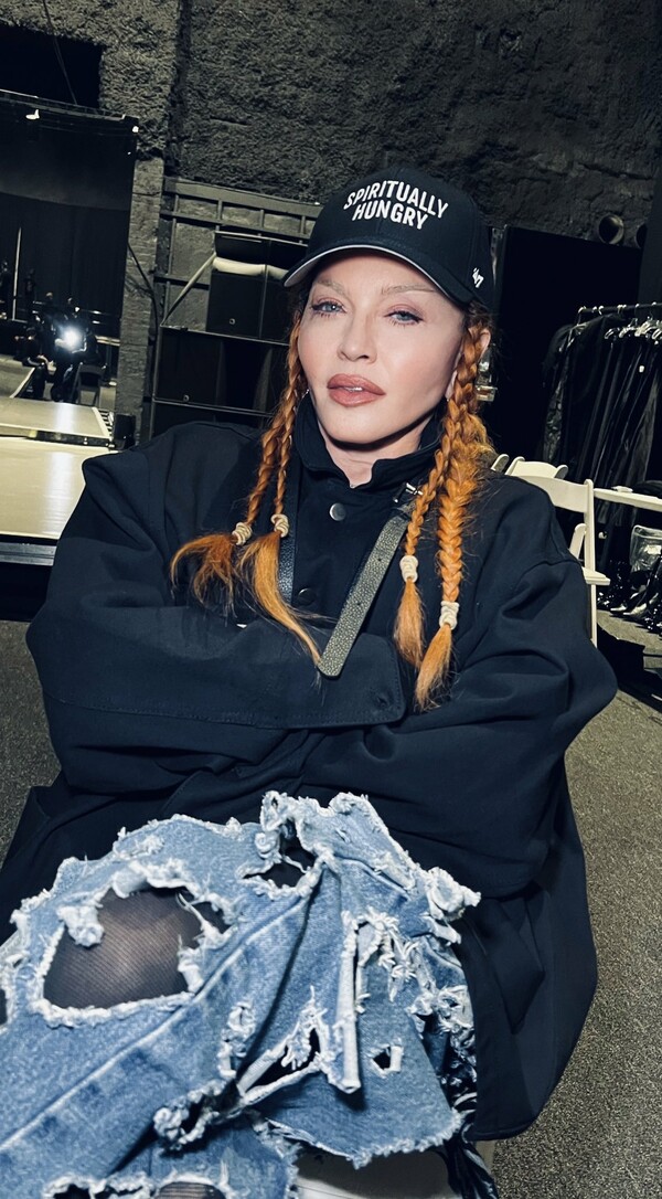 Η Madonna γελά με τα σχόλια για το πρόσωπό της- «Δείτε πόσο χαριτωμένη είμαι τώρα, που έφυγε το πρήξιμο της επέμβασης»