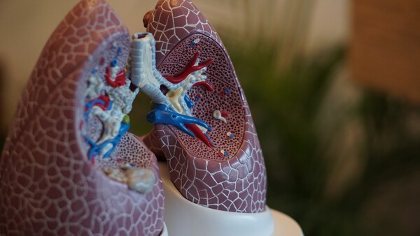 Τζανάκης για καρκίνο του πνεύμονα: Κάθε χρόνο χάνεται μια μικρή πόλη στην Ευρώπη