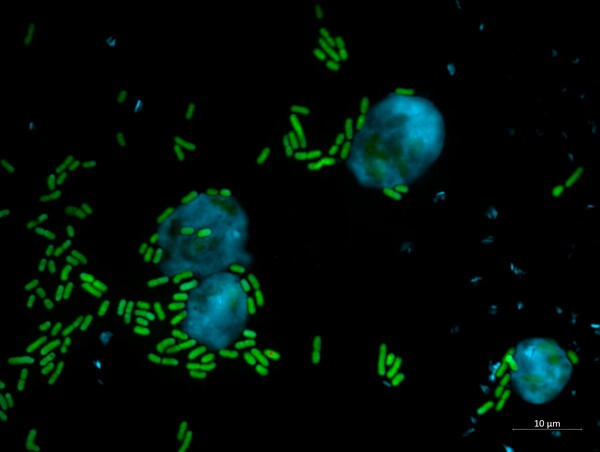 Η επιστήμη αναγνωρίζει το έργο του Κιάνου Ριβς και δίνει το όνομα του σε ενώσεις που ξεπαστρεύουν μύκητες 