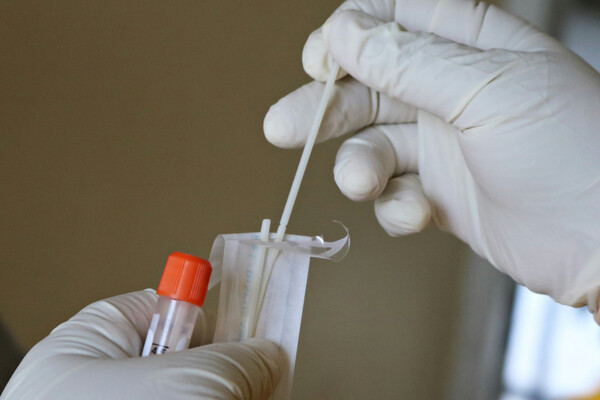 ΕΟΔΥ: Μείωση στα κρούσματα από κορωνοϊό αλλά νέα σοβαρά από γρίπη