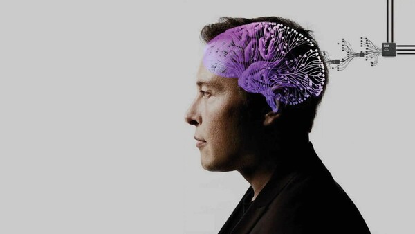 Ίλον Μασκ: Η Neuralink έκανε την πρώτη εμφύτευση μικροτσίπ σε ανθρώπινο εγκέφαλο