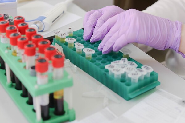 Πώς ξεκίνησε η πανδημία Covid-19: Οι Αμερικανοί επιστήμονες που πιστεύουν ότι ο κορωνοϊός προήλθε από εργαστήριο